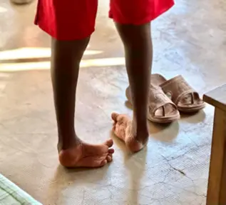 Pourquoi faut-il soigner le Pied Bot ?
